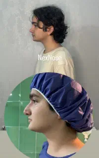 جراحی بینی فقط 59ملیون