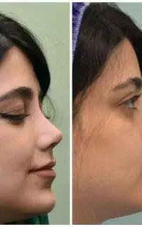عمل بینی جشنواره نوروزی با قیمت سال ۴۰۴