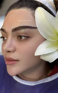 جشنواره میکروکاشت ابرو با و بدون جراحی شیراز