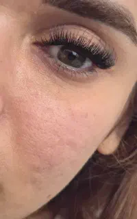 کاشت مژه موقت با ماندگاری بالا