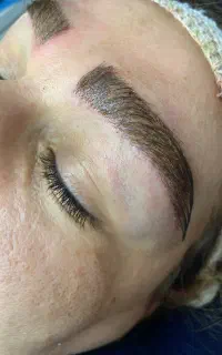 کاشت مو و ابرو در نوبهار