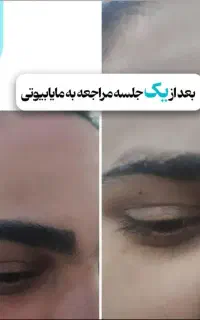 اولین مرکز تخصصی ریموو تتو ابرو و بدن(مایابیوتی)