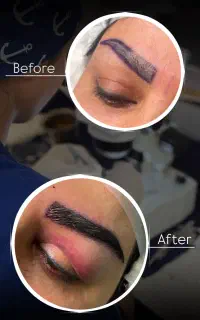 جراحی زیبایی تخصصی ساکشن غبغب،کاشت مو و ابرو و...