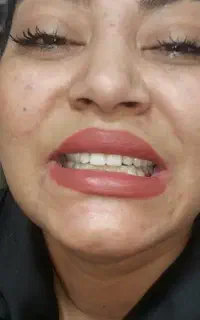 دندانسازی ماهر یزد در کرمان تحویل یک روزه، اقساط