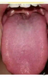 مشاوره از روی زبان