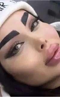 تزریق ژل بوتاکس فیلربادی باسن بیکینی هیپ دیپ لیفت