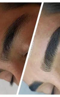 اصلاح تخصصی (درماپلینگ) واصلاح ابروهاشوری وپاکسازی