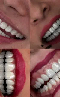 کلینیک دندانپزشکی دنو (جرم گیری و معاینه رایگان)