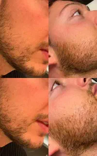وقتشه با ریشات آشنا بشی