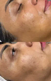 فیشال تخصصی پوست