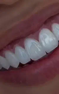 دندانپزشکی درمانی و زیبایی تعرفه قبل از افزایش