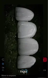 استخدام دستیار دندانپزشک