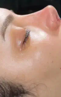 عمل جراحی زیبایی بینی،لیفت صورت،پلک،اندام