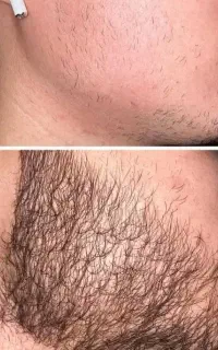 ریشه سبیلو باش