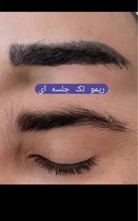 «دکتر کامبیز محمدپور»مرکزتخصصی ریمو تتو رنگی وتیره