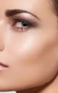مطب خانم دکتر کژال شاه ویسی تزریق ژل بوتاکس