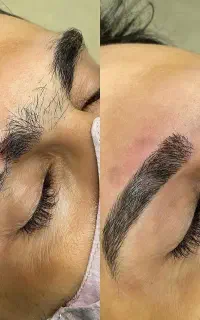 بدرنگی لب-ابروی نامتقارن-چشم بی‌روح
