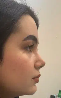 فستیوال عمل بینی برای شهر دیواندره/۴۳تومن/درتهران