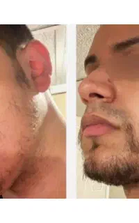 25 روزه پرش کن