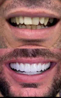 دندانسازی دریکوند