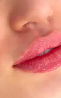 خدمات لیزر فیلر بوتاکس