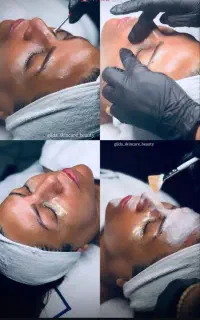 فیشیال جوانساز و درمانی