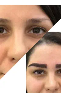 زیبایی بیشتر با کاشت ابرو