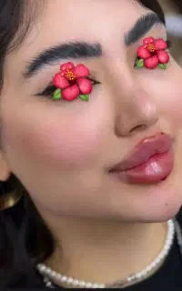 ژل بوتاکس