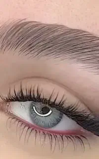 کاشت مژه هیدن