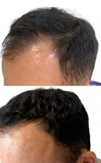 قبل اینکه کاشت کنی اینو تست کن
