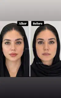 کانتورینگ و زاویه سازی صورت (طرح بهاری)