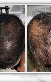 موهای زیبا تر میخوای
