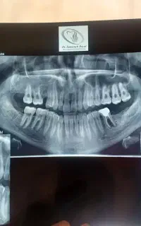 آموزش دستیاری دندانپزشکی
