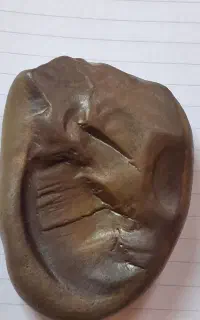 سنگ‌‌گلگسیونی