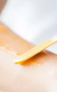 اپلاسیون بانوان