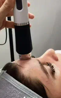 ورکشاپ آموزشی پلاژن‌تراپی پکیج کامل ۹۰۰ هزار تومان