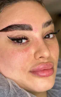 مرکز کاشت ابرو موقت