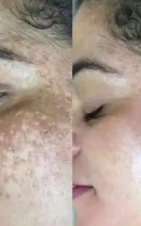 بیوممتیک