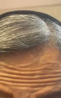 بوتاکس مصپورت۲میلیون پزشک متخصص
