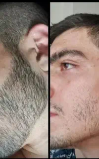 چرا جای ریشت خالیه