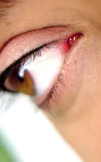 نیازمند مدل میکرو بنمژه