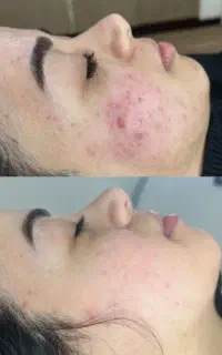 پاکسازی و فشیال