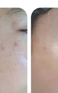 پاکسازی صورت