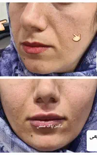 مطب زیبایی دکتر پاک منش ،ژل و بوتاکس و لیزر