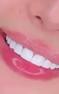 دندانپزشکی به صورت اقساط