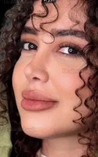 عمل جراحی بینی /لیفت صورت/پلک