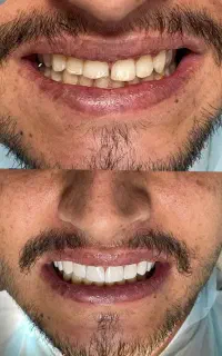 جشنواره دندانپزشکی در کرمانشاه