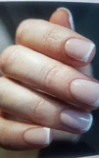 کاشت ناخن۳۸۰