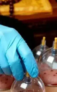 جاانداختن ناف،شستن گوش،حجامت،پلا سماخال،زگیل