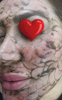 تخلیه لک بامتد پکینگ اپ گاز